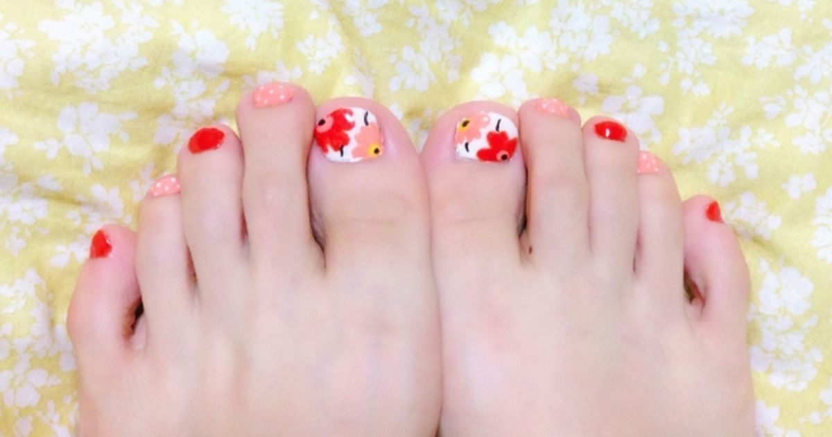 巻き爪はジェルネイルを避けるべき？