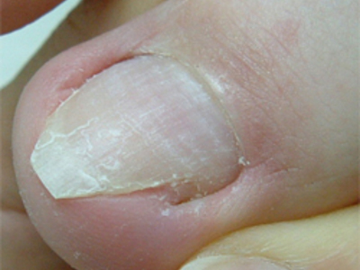 切りすぎた爪